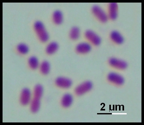 haemophilus influenzae